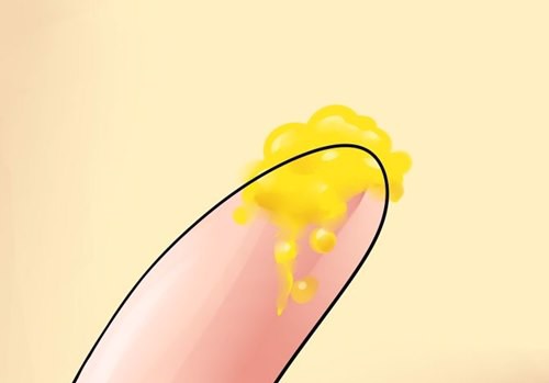 Cách khắc phục tinh trùng có màu vàng hiệu quả