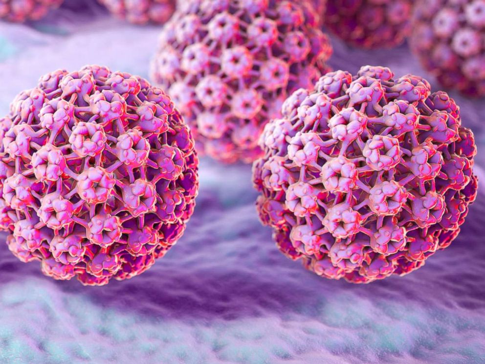 Làm sao khi kết quả xét nghiệm dương tính virus HPV?