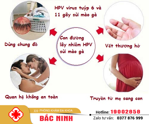 HPV virus sùi mào gà là gì?