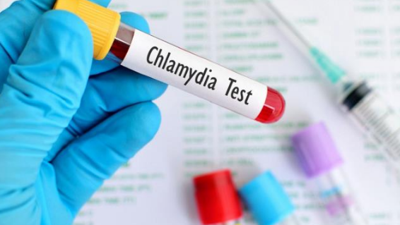 Xét nghiệm nhiễm Chlamydia trachomatis